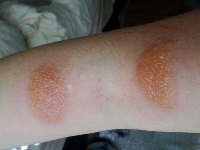 IMG_20120430_094016 (1)